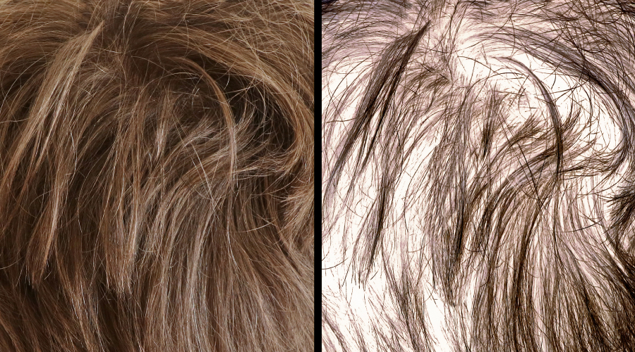 Thin Hair to Thick Hair