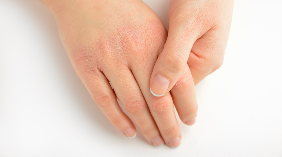 best sunscreen for sensitive skin