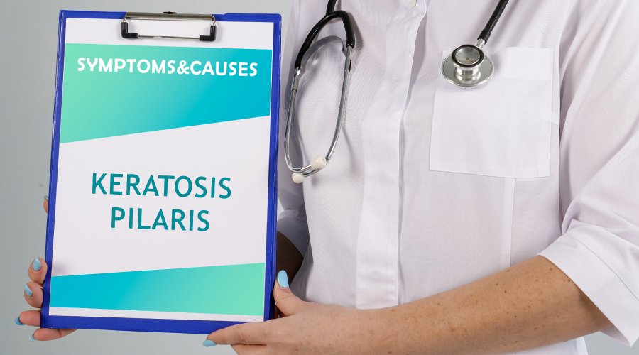 keratosis