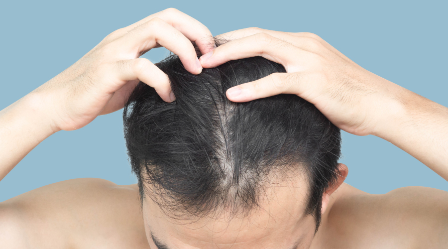 hairline growth tips