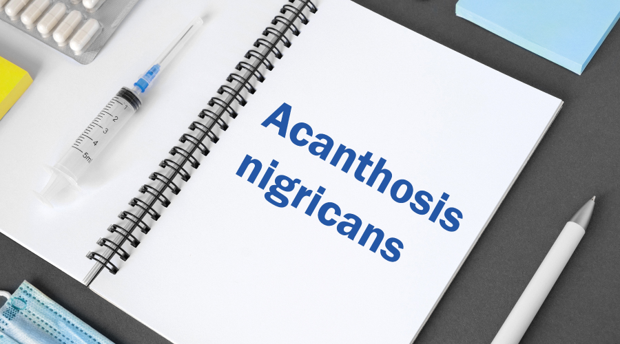 Acanthosis nigricans