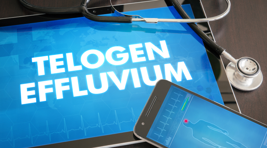 telogen effluvium