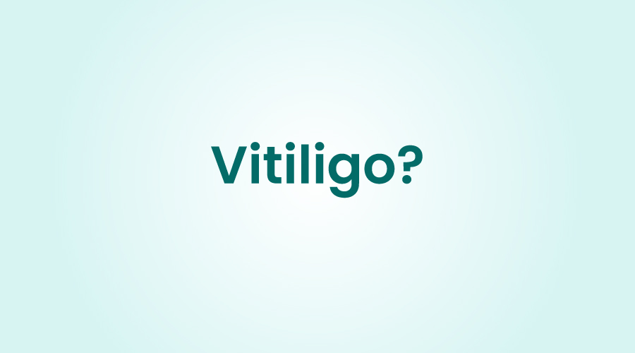 Vitiligo